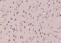 LIM Kinase 1 Antibody, Novus Biologicals:Antibodies:Primary Antibodies