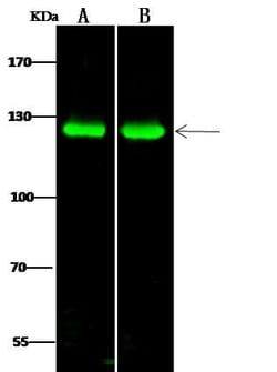 PKN1 Antibody, Novus Biologicals:Antibodies:Primary Antibodies