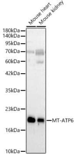 MT-ATP6 Antibody - Azide and BSA Free, Novus Biologicals 100 &mu;g | Buy Online | Novus Biologicals | Fisher Scientific