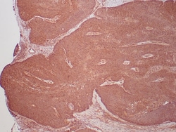 HPV16/HPV18 E6 Mouse anti-Virus, Clone: HPV16/1295 + HPV18/1297, Novus