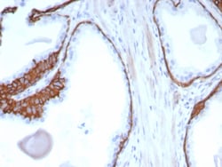 Cytokeratin 13 Mouse anti-Human, Mouse, Rat, Rabbit, Clone: KRT13/2850,