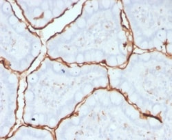 ACE/CD143 Mouse anti-Human, Clone: 9B9, Novus Biologicals:Antibodies:Primary