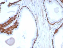 Cytokeratin 13 Antibody (KRT13/2850) - Azide and BSA Free, Novus Biologicals
