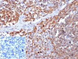 Parvin gamma Antibody (8C5.2) - Azide and BSA Free, Novus Biologicals 100 &mu;g | Buy Online | Novus Biologicals | Fisher Scientific