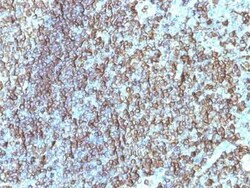 HLA DRB1 Antibody (SPM288) - Azide and BSA Free, Novus Biologicals 0.1 mg | Buy Online | Novus Biologicals | Fisher Scientific