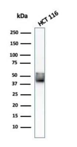 Cytokeratin 8 Antibody (KRT8/803) - Azide and BSA Free, Novus Biologicals