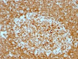 CD74 Antibody (LN-2 + CLIP/813) - Azide and BSA Free, Novus Biologicals 0.1 mg | Buy Online | Novus Biologicals | Fisher Scientific