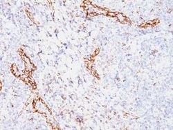 VEGF Antibody (VEGF/1063) - Azide and BSA Free, Novus Biologicals 0.1 mg | Buy Online | Novus Biologicals | Fisher Scientific