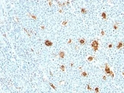 S100A9 Antibody (MRP14/840) - Azide and BSA Free, Novus Biologicals 0.1 mg | Buy Online | Novus Biologicals | Fisher Scientific