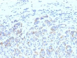 TYRP1 Antibody (SPM611) - Azide and BSA Free, Novus Biologicals 0.1 mg | Buy Online | Novus Biologicals | Fisher Scientific