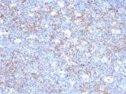 MCAM/CD146 Antibody (C146/634) - Azide and BSA Free, Novus Biologicals