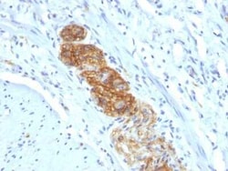 NCAM-1/CD56 Antibody (NCAM1/784) - Azide and BSA Free, Novus Biologicals