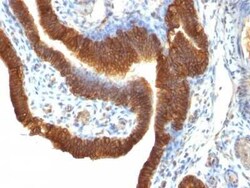 EpCAM/TROP1 Antibody (SPM491) - (ECD) - Azide and BSA Free, Novus Biologicals 0.1 mg | Buy Online | Novus Biologicals | Fisher Scientific