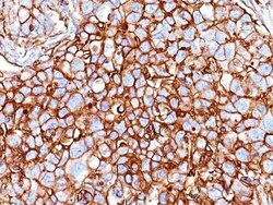 CD44 Antibody (HCAM/918) - Azide and BSA Free, Novus Biologicals 0.1 mg;