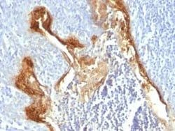 Involucrin Antibody (IVRN/827) - Azide and BSA Free, Novus Biologicals 0.1 mg | Buy Online | Novus Biologicals | Fisher Scientific