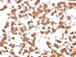 Cytokeratin 18 Antibody (C-04 (same as Ks18.04)) - Azide and BSA Free, Novus Biologicals 0.1 mg | Buy Online | Novus Biologicals | Fisher Scientific