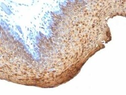 Cytokeratin 10/13 Antibody (DE-K13) - Azide and BSA Free, Novus Biologicals 0.1 mg | Buy Online | Novus Biologicals | Fisher Scientific