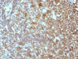 CD45RA Antibody (SPM504) - Azide and BSA Free, Novus Biologicals 0.1 mg | Buy Online | Novus Biologicals | Fisher Scientific