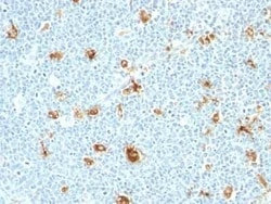 S100A9 Antibody (CAGB/426) - Azide and BSA Free, Novus Biologicals 0.1 mg | Buy Online | Novus Biologicals | Fisher Scientific