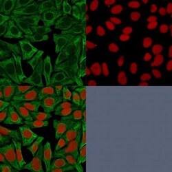 Cytokeratin 18 Antibody (DE-K18) - Azide and BSA Free, Novus Biologicals 0.1 mg | Buy Online | Novus Biologicals | Fisher Scientific