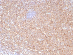 HLA B Antibody (JOAN-1) - Azide and BSA Free, Novus Biologicals 0.1 mg;