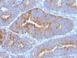 Thomsen-Friedenreich Antigen Antibody (SPM320) - Azide and BSA Free, Novus Biologicals 0.1 mg | Buy Online | Novus Biologicals | Fisher Scientific