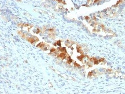Mesothelin Antibody (SPM143) - Azide and BSA Free, Novus Biologicals 100 &mu;g | Buy Online | Novus Biologicals | Fisher Scientific