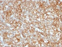 EMMPRIN/CD147 Antibody (BSG/963) - Azide and BSA Free, Novus Biologicals 0.1 mg | Buy Online | Novus Biologicals | Fisher Scientific