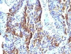 Melanoma Associated Antigen (KBA.62) Antibody (KBA.62) - Azide and BSA Free, Novus Biologicals 0.1 mg | Buy Online | Novus Biologicals | Fisher Scientific