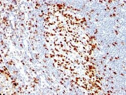 ZAP70 Antibody (ZAP70/528) - Azide and BSA Free, Novus Biologicals 0.1 mg | Buy Online | Novus Biologicals | Fisher Scientific