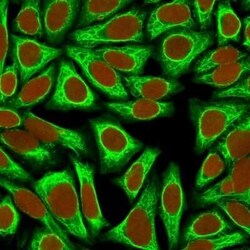 Cytokeratin 18 Antibody (KRT18/836) - Azide and BSA Free, Novus Biologicals