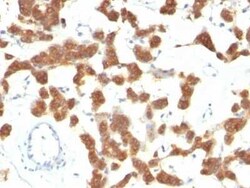 Cytokeratin 18 Antibody (B23.1) - Azide and BSA Free, Novus Biologicals