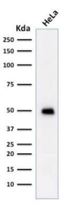 p53 Antibody (TRP/817) - Azide and BSA Free, Novus Biologicals 0.1 mg;