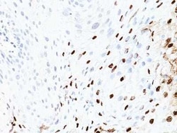 HPV16 Antibody (SPM405) - Azide and BSA Free, Novus Biologicals 0.1 mg | Buy Online | Novus Biologicals | Fisher Scientific