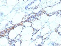 Myosin heavy chain 11 Antibody (SPM201) - Azide and BSA Free, Novus Biologicals