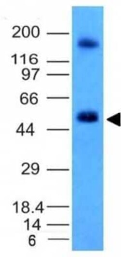 Carbonic Anhydrase IX/CA9 Antibody (CA9/781) - Azide and BSA Free, Novus