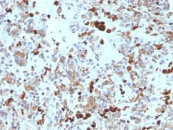 MITF Antibody (MITF/915) - Azide and BSA Free, Novus Biologicals 0.1 mg | Buy Online | Novus Biologicals | Fisher Scientific