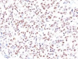 MITF Antibody (MITF/915) - Azide and BSA Free, Novus Biologicals 0.1 mg | Buy Online | Novus Biologicals | Fisher Scientific