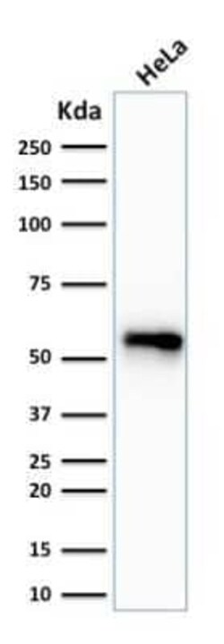 Cytokeratin 7 Antibody (SPM270) - Azide and BSA Free, Novus Biologicals 0.1 mg | Buy Online | Novus Biologicals | Fisher Scientific