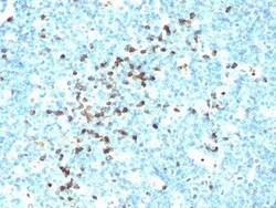 Lambda Light Chain Antibody (LcN-2) - Azide and BSA Free, Novus Biologicals 100 &mu;g | Buy Online | Novus Biologicals | Fisher Scientific