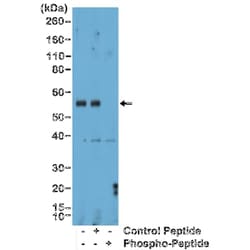 SMAD1/5/9 Antibody (RM487), Novus Biologicals 100 &mu;g; Unconjugated:Antibodies,
