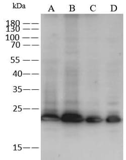 RAB11B Antibody, Novus Biologicals 50 &mu;g; Unconjugated:Antibodies, Polyclonal