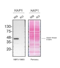 Casein Kinase 2 alpha Antibody (S05-7F8), Novus Biologicals:Antibodies:Primary