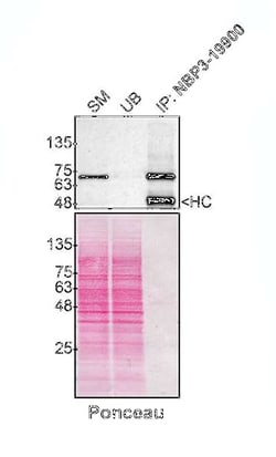 Optineurin Antibody (S01-2C5), Novus Biologicals 100 &mu;g; Unconjugated:Antibodies,
