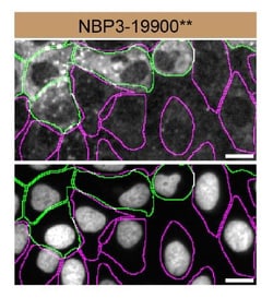 Optineurin Antibody (S01-2C5), Novus Biologicals 100 &mu;g; Unconjugated:Antibodies,