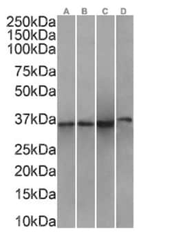 Annexin A1 Antibody (SAIC-13B-19) - Azide and BSA Free, Novus Biologicals:Antibodies:Primary