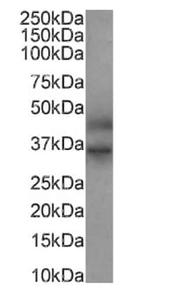 FEN-1 Antibody (SAIC-21C-4) - Azide and BSA Free, Novus Biologicals:Antibodies:Primary