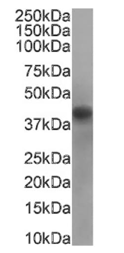 RRM2 Antibody (SAIC-30C-18) - Azide and BSA Free, Novus Biologicals 0.025