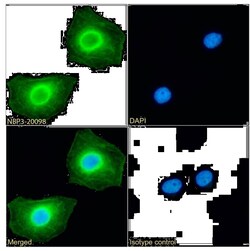 RRM2 Antibody (SAIC-30C-18) - Azide and BSA Free, Novus Biologicals 0.025