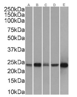 Peroxiredoxin 2 Antibody (SAIC-34B-124) - Azide and BSA Free, Novus Biologicals:Antibodies:Primary